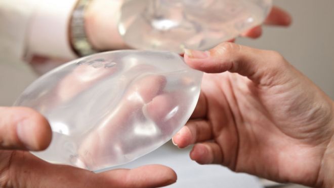 USE_BREAST_IMPLANTS.jpg